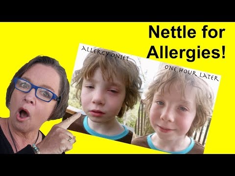 ✅ Nettle for Allergies: A Simple Nettle Tea Remedy for Allergies