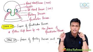 Development of Face & Palate | Head and Neck Embryology Made Simple screenshot 5