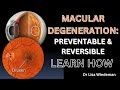 Easy to understand explanation protect yourself from losing vision from macular degeneration