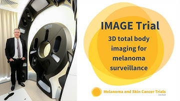 3D total body imaging for melanoma surveillance