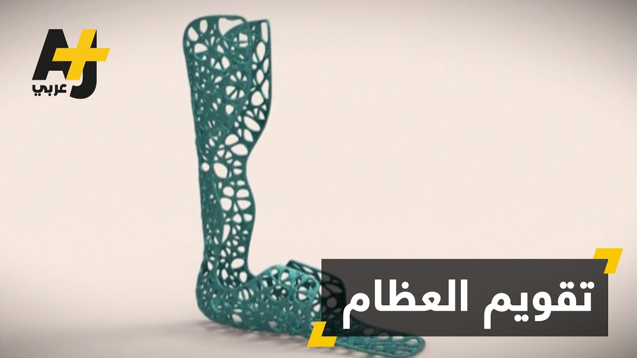 تقنية ثلاثية الأبعاد لتقويم العظام