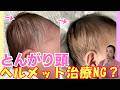【赤ちゃんのとんがり頭】プロが教える自宅ケアと改善マッサージ