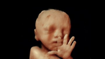 Detailed anomaly scan