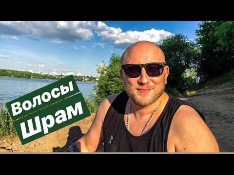 ПРО ВОЛОСЫ, ШРАМ И ВСЕ ОСТАЛЬНОЕ