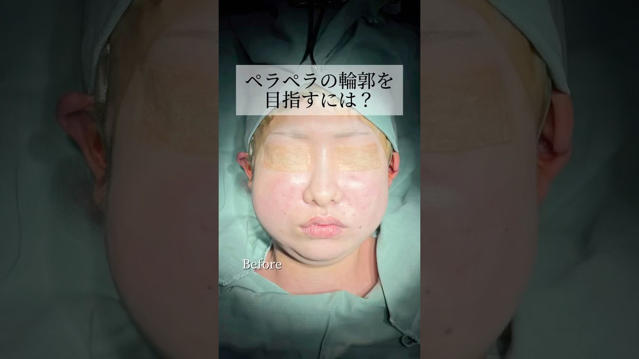 【ペラペラの輪郭を目指すには?】#shorts