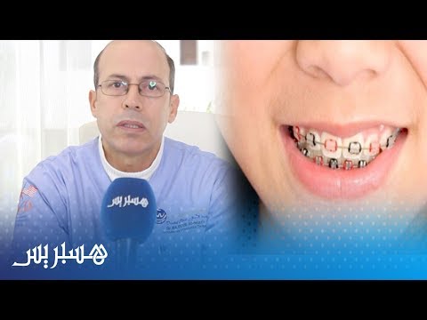فيديو: ماذا باك الأسنان؟