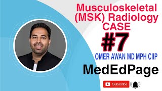 Musculoskeletal (MSK) Radiology CASE # 7