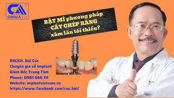 BẬT MÍ phương pháp CẤY GHÉP RĂNG xâm lấn TỐI THIỂU ? I BSCKII. Bùi Cúc