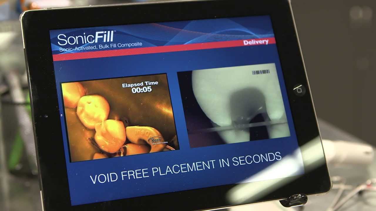 Kerr Dental shares details on the SonicFill™ bulk fill composite system YouTube