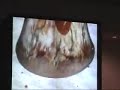End of video