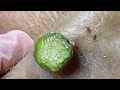 [ASMR] Sharp Ingrown Trimmed! Professional Pedicure DR LEE’S ULTIMATE ZITPOPPER 2808M3 0276