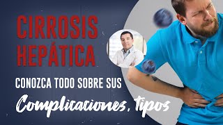 Cirrosis Hepática, complicaciones, tipos de cirrosis Dr. Frans Serpa Cirujano de Hígado