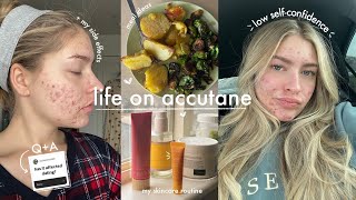 my accutane experience (side effects, self confidence, etc!)