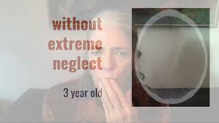Celebrity Supporting Students with The Behavior Code | AnthroMed Education Webinar Wealth