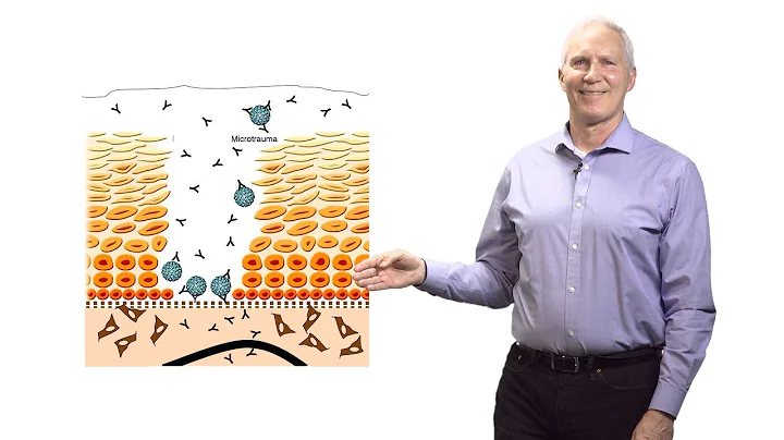 John Schiller (NCI at NIH) 2: Why Do HPV Virus-Lik...