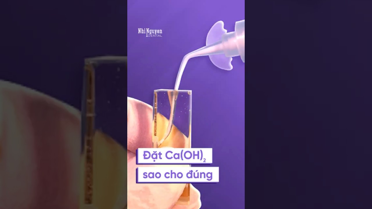 Hướng dẫn đặt Ca(OH)₂ vào ống tủy đúng kỹ thuật để tối ưu hiệu quả điều trị | Endo Short