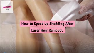 Laser Hair Removal treatment at Faces Med Spa in Maryland