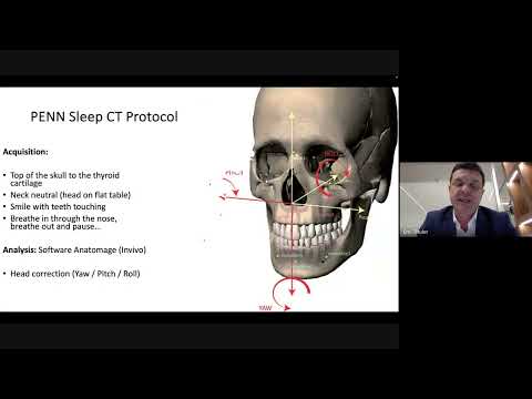 Determinantes anatomicos del colapso de la vía aerea respiratoria - Dr Eric Thuler