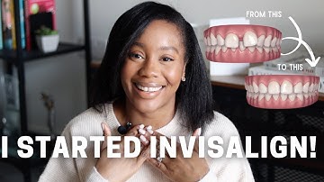 INVISALIGN JOURNEY #1 | Closing My Gap, Choosing A Dentist, Cost, Pain & Things I Didn