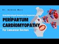 Anaesthesiologist’s Quandary in Suspected Peripartum Cardiomyopathy for LSCS | Dr. Ashish Mali