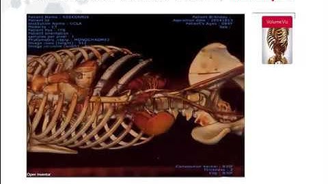 Webinar | Open Inventor | Introduction for Medical Software Applications Development