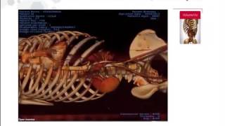 Webinar | Open Inventor | Introduction for Medical Software Applications Development
