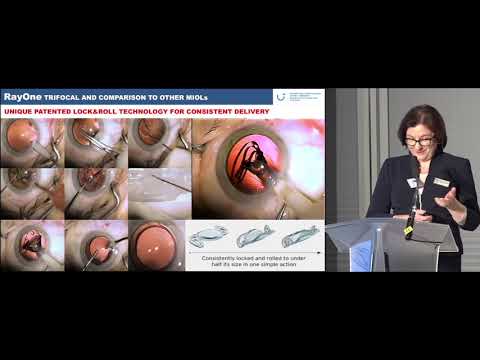 Comparing the RayOne Trifocal IOL With Competitors by Ewa Mrukwa-Kominek, MD, PhD