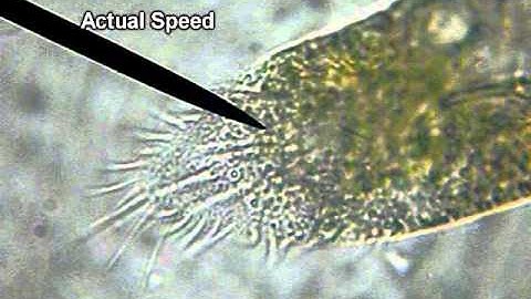 Stichotrich Cirri (High Magnification)
