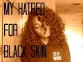 How It Felt Being A Dark Girl