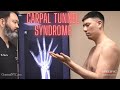 Avoid surgery for carpal tunnel syndrome  specific chiropractic nyc