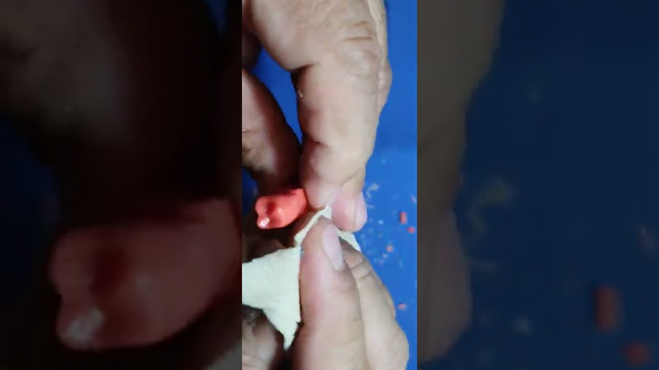 Tallado del Segundo Premolar Inferior