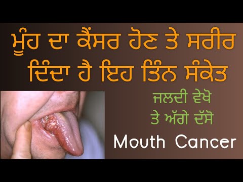 ਮੂੰਹ ਦਾ ਕੈਂਸਰ ਹੋਣ ਤੇ ਸਰੀਰ ਦਿੰਦਾ ਤਿੰਨ ਸੰਕੇਤ | Mouth Cancer Symptoms in Punjabi | Cancer precautions