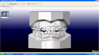 Orthocad.avi