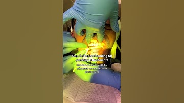 Starting Clear Aligner Therapy in Review 🤠 #Dentist #ClearAligners #Braces #DentalOffice #shorts