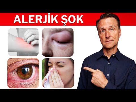 Dr. Eric Berg - Türkçe Kanalı