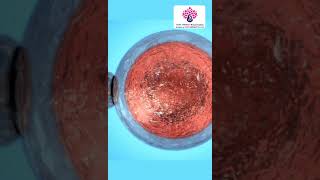 Detailed Preserving Potential: The Egg Freezing Process Profile