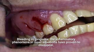 Parodontik - Gennadent