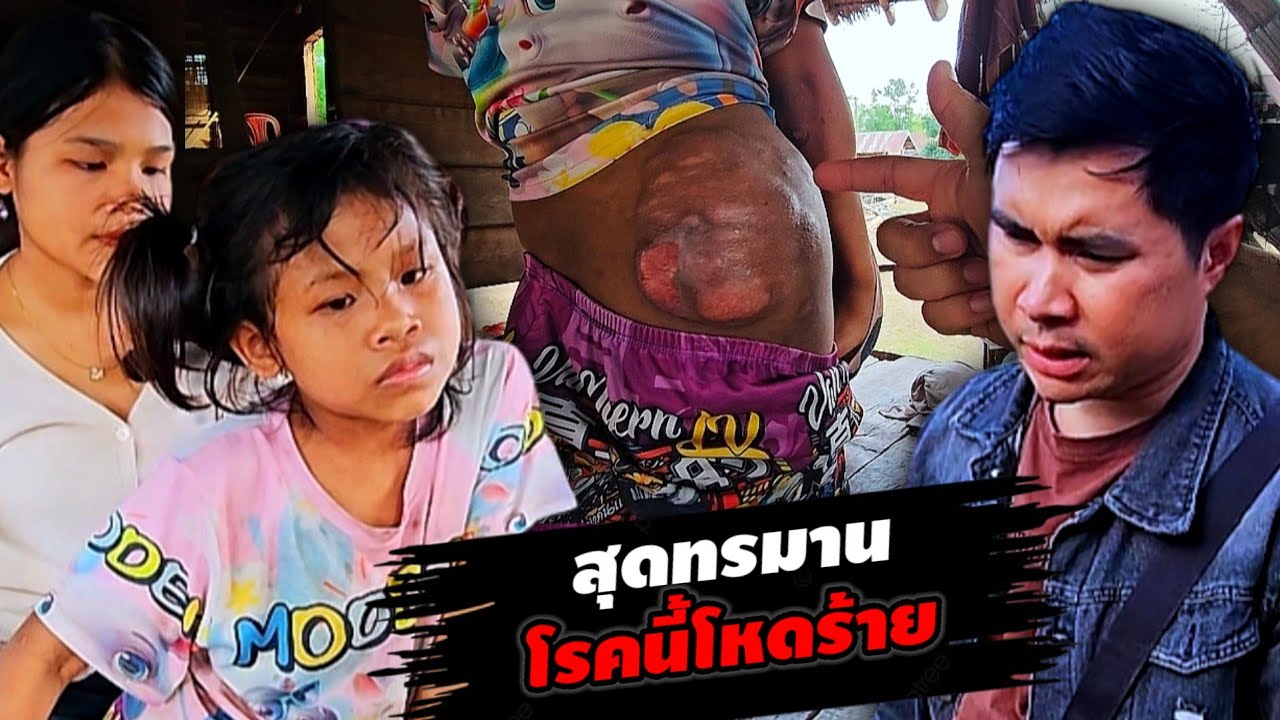 แจ้งข่าวดีน้องลี มีแนวโน้มที่จะรักษาต่อ 18 มกราคม ค.ศ. 2026
