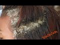 Combing Big Dandruff Flakes Satisfying #1475