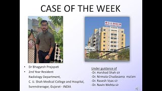 Case of the week - OSTEOSARCOMA screenshot 1