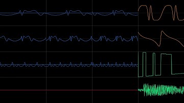 What if Doom II had a proper OPL3 soundtrack: Running from Evil