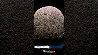 Hair Transplant In Turkey 2026: Bella Clinic Best Results, Sapphire Fue & Dhi
