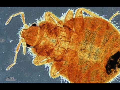 Getting Rid of Bedbugs in 3 Steps without an Exterminator!