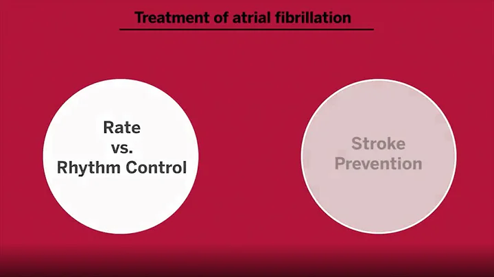 Anticoagulation in Atrial Fibrillation - DayDayNews