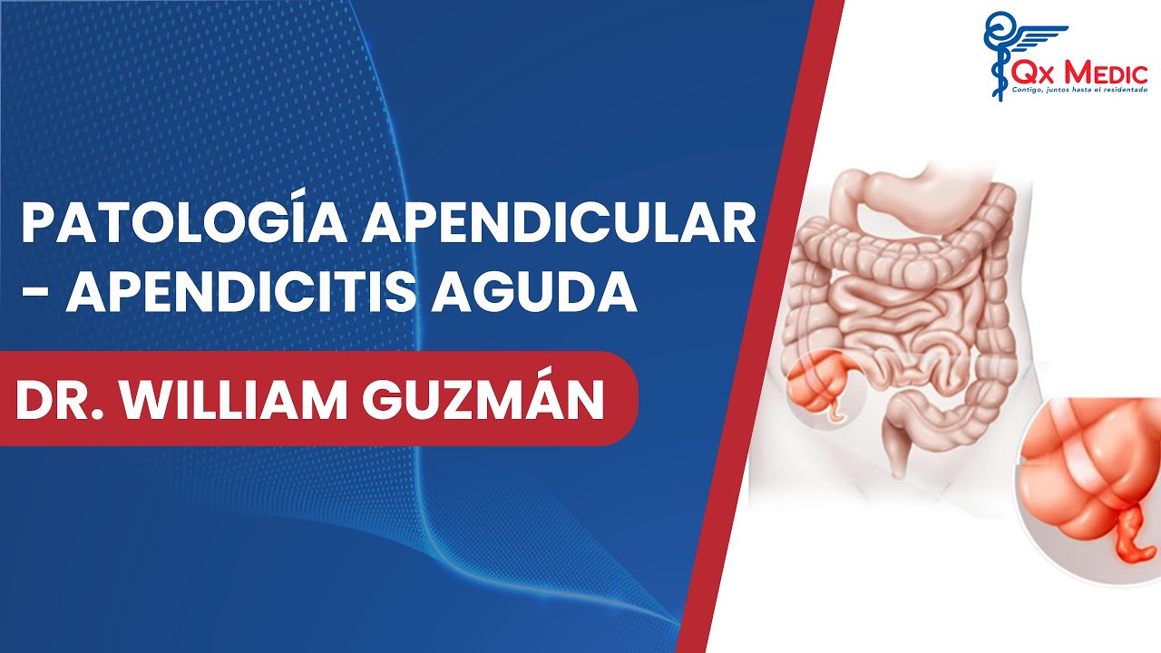 Patología Apendicular - Apendicitis Aguda - YouTube