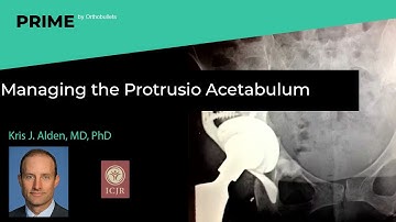 Managing the Protrusio Acetabulum - Kris J. Alden, MD, PhD