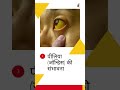 पित्ताशय की पथरी (Gallbladder Stone) के 4 मुख्य लक्षण | माँ एण्ड फैमिली मल्टीस्पेशलिटी हॉस्पिटल