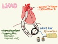 LVAD 01: Anatomy and Physiology