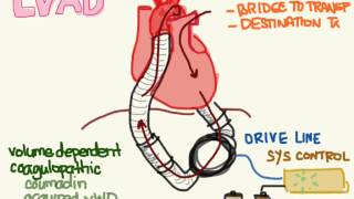 LVAD 01: Anatomy and Physiology