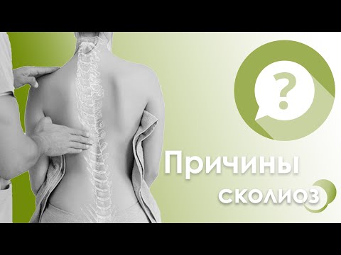 Причины возникновения сколиоза: теория натяжения спинного мозга